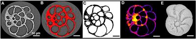 3D morphological variability in foraminifera unravel environmental changes in the Baltic Sea entrance over the last 200 years